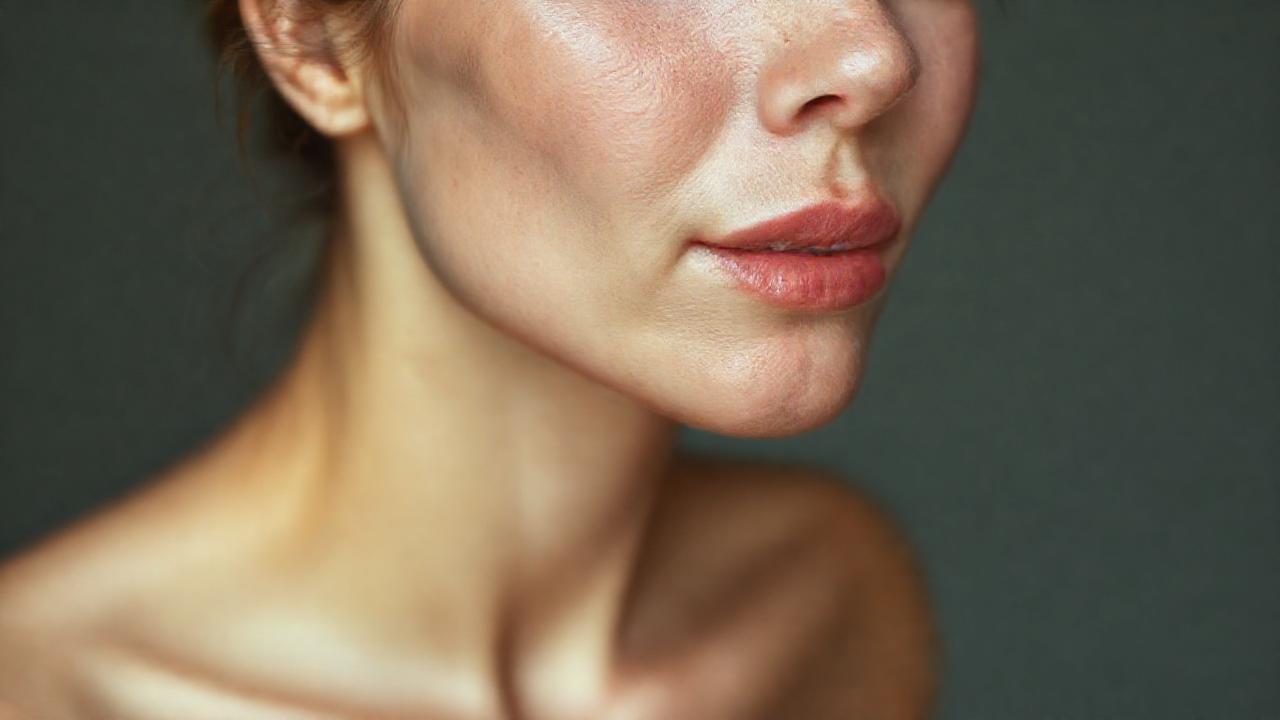 Superficial spreading melanoma